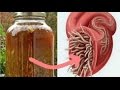 Cure All Infections And Kill All Parasites With This DIY Antibiotic Cure All Infections And Kill All Parasites With This DIY Antibiotic