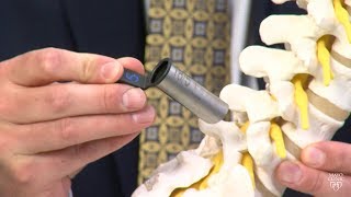 Dr. Matthew Neal: Minimally invasive spine surgery