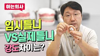 임시틀니, 어느정도의 힘을 가졌나, 또 실제 틀니와 어떻게 다른가. 틀니치과 원장이 직접 설명하는 임시틀니와 틀니