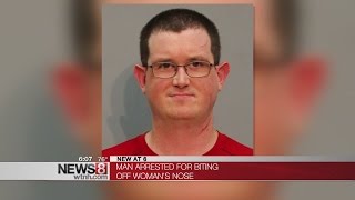 Man arrested for biting off woman's nose