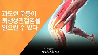 과도한 운동이 퇴행성관절염을 일으킬 수 있다 - (2016.8.31_591회 방송)_세월의 무게, 퇴행성 관절염