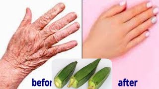 Remove wrinkles on hands and fingers have a baby soft hands