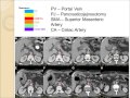 pancreas cancer and radiation