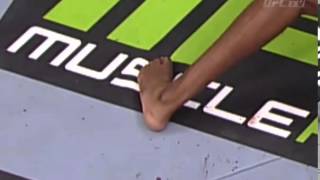 Jon Jones Broken toe UFC 159 VS Chael Sonnen