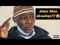 ALLIEN SKIN NGA ATUUKA KU KOOTI OLWALEERO, Bamusazeeko envili. #trending #subscribe