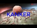 KANKER - Perbedaan kanker dan tumor