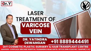 Laser Treatment for Varicose Veins | Dr. Yatindra Dewangan | Raipur, Chhattisgarh