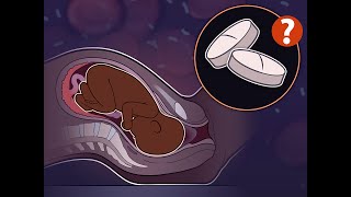 Azithromycin in Women Planning a Vaginal Birth | NEJM