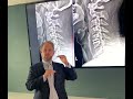 dr. good explains why preserving the motion in your spine is very important