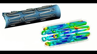 Optimize Your Stent Design With Powerful Parametric CAE Technology of DEP MeshWorks