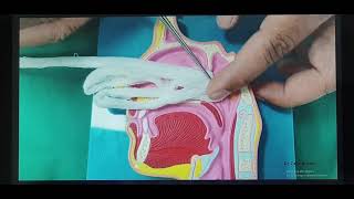 Nose bleed Part 5 (English) Patient teaching programme