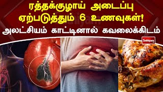 ரத்தக்குழாய் அடைப்பு ஏற்படுத்தும் 6 உணவுகள்! அலட்சியம் காட்டினால் கவலைக்கிடம் | Web Special