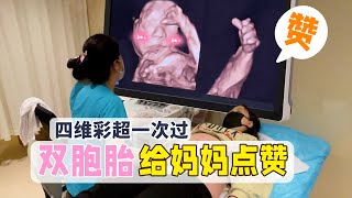 双胞胎在妈妈肚子里什么样？孕妇做四维彩超竟看到宝宝在点赞！