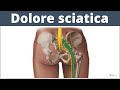 CURA la SCIATICA con questo SEMPLICE ESERCIZIO