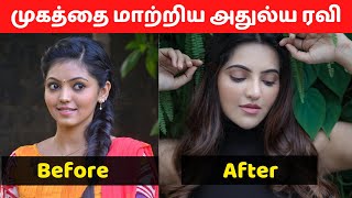 Athulya Ravi Transformed with plastic surgery | Actress with plastic surgery | kadhal kan kattudhe