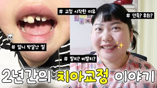 상처뿐인 2년간의 치아교정 이야기😬🦷 | 앞니 박살난 썰💥 • 후회? 만족? • 유지장치 • 잇몸 수술 •  발치교정 • 교정 단점