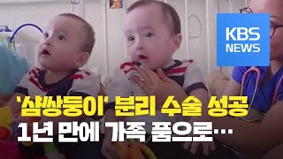 페루 ‘샴쌍둥이’ 분리 성공…“크리스마스 선물” / KBS뉴스(News)