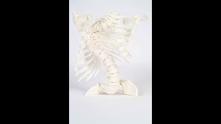 3D printing for spinal surgery