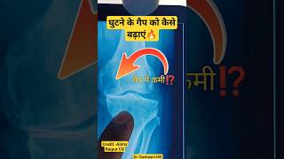 घुटने का गैप बढ़ा लो 🔥 ग्रीस कम क्यों होता है⁉️ Increase Your Knee Gap ✓✓ #kneearthritis #kneepain