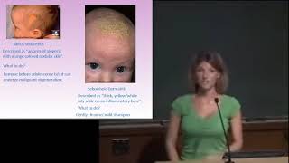 Emma Holliday Pediatrics W/ Her PP Slides |High-Yield USMLE Step| PP Download Link Below| Shelf Exam