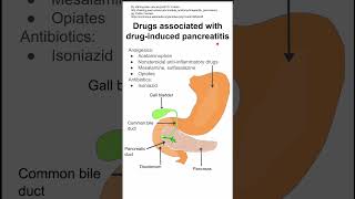 Drugs associated with drug-induced pancreatitis