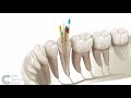 Endodontie | Wurzelbehandlung | City Dental Clinic Bratislava