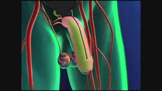 Erectile Dysfunction (ED) - Causes, symptoms and treatment modalities ...