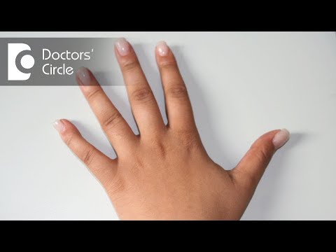 Is it normal to have dark knuckles?