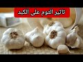 تاثير الثوم على الكبد