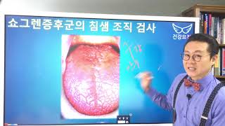 쇼그렌 증후군이 약물 때문에 올 수 있나요? Sjogren's syndrome