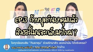 Q\u0026A  ถ้าหยุดกินยาคุมแล้วสิวฮอร์โมนจะกลับมาไหม | NeverSurrender EP.3