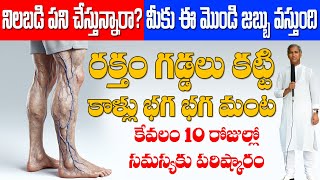 మీరు నిలబడి పని చేస్తున్నారు ? ఐతే మీకు ఈ మొండి జబ్బు వస్తుంది | Dr Manthena Satyanarayana Raju