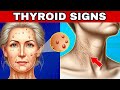 🚨 8 THYROID WARNING SIGNS (Hypothyroidism and Hyperthyroidism)