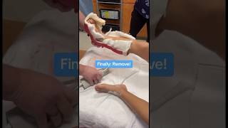 Removing a cast in 4 easy steps! | Boston Children's Hospital #castsaw #shorts