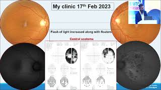 AIOCMTC2 2023 GP7 topic Dr Basavaraj Tigari Role of multi modal imaging in central scotoma