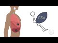 c5a neutralization is protective in severe pneumonia