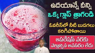 Diet Plan to Reduce Ovarian Cysts | Hormonal Balance | PCOD | Kidney Stones | Manthena's Health Tips