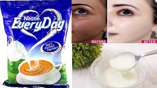 Skin Whitening Milk Powder Face Pack for Fair, Spotless & Glowing Skin | Milk Powder Face Mask DIY