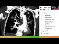 Complex: Pulmonary Embolism