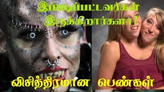 ஒரே உடலில் இரண்டு தலைகளா? 😮 #tamil #tamilfacts