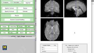 SPM Tutorial #3: Looking at the Data