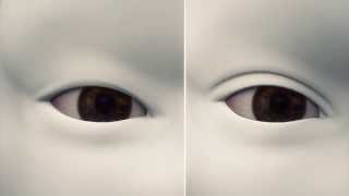 How double eyelid surgery works