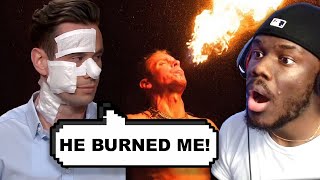 MAN`S FACE GOT BURNED BREATHING FIRE HE`S SUEING FOR $1,000,000 (Injury Court)