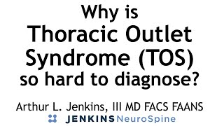 Why is diagnosing Thoracic Outlet Syndrome so difficult?