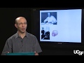 Daniel H. Lowenstein, MD, Seizures and Epilepsy Part 1: How Does the EEG Work?