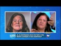 Antes e depois mulher com vitiligo passa por tratamento na pele