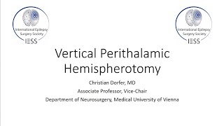 Vertical perithalamic hemispherotomy: Anatomy, Technique, Complications