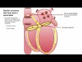 Bayside Heart | PPM and ICD Implant