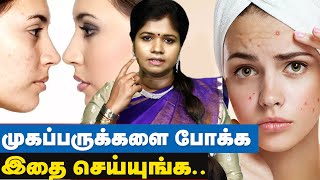 முக பொலிவு பெற எளிய வழிகள் | Face Brightening Tips in Tamil | Siddha Treatment | Yoga Vidhya