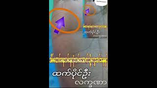 အိမ်ထောင်ရေးလမ်းဟာကွေးဆင်းနေသူအကြောင်း.....#HtetPaing #ဗေဒင်လက္ခဏာ